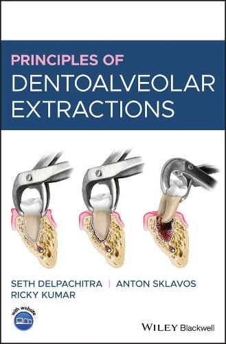 Паперова книга «Principles of Dentoalveolar Extractions», авторів Антон Склавос, Рікі Кумар, Сет Делпачітра - фото №1