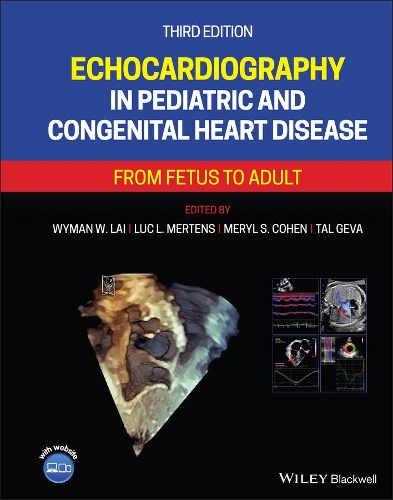 Бумажная книга «Echocardiography in Pediatric and Congenital Heart Disease: From Fetus to Adult» - фото №1