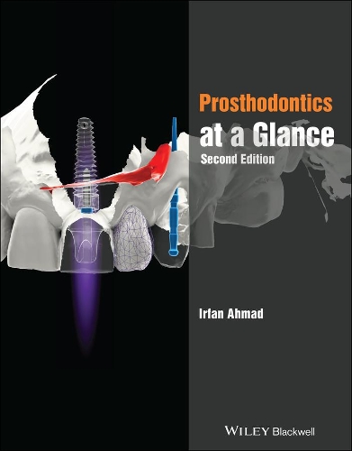 Паперова книга «Prosthodontics at a Glance», автор Ірфан Ахмад - фото №1