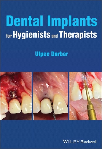 Бумажная книга «Dental Implants for Hygienists and Therapists», автор Ульпи Р. Дарбар - фото №1