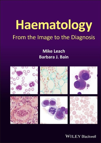 Бумажная книга «Haematology: From the Image to the Diagnosis», авторов Барбара Дж. Бэйн, Майк Лич - фото №1
