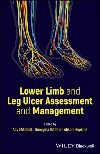 Паперова книга «Lower Limb and Leg Ulcer Assessment and Management» - фото №1