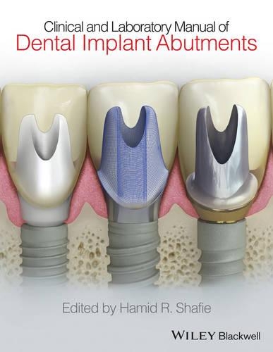 Паперова книга «Clinical and Laboratory Manual of Dental Implant Abutments», автор Хамід Р. Шафі - фото №1