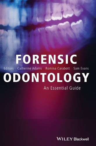 Бумажная книга «Forensic Odontology: An Essential Guide», авторов Кэтрин Адамс, Ромина Каработт, Сэм Эванс - фото №1