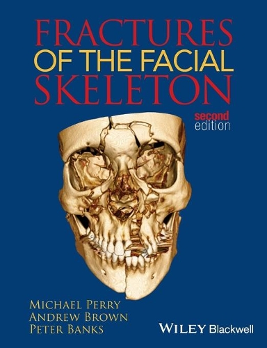 Бумажная книга «Fractures of the Facial Skeleton», авторов Эндрю Браун, Майкл Перри, Питер Бэнкс - фото №1