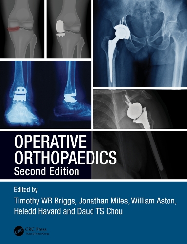 Паперова книга «Operative Orthopaedics» - фото №1