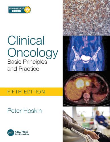 Паперова книга «Clinical Oncology: Basic Principles and Practice», автор Пітер Хоскін - фото №1