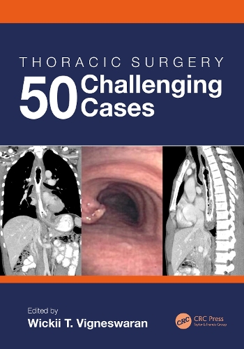 Бумажная книга «Thoracic Surgery: 50 Challenging cases» - фото №1