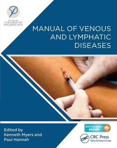 Бумажная книга «Manual of Venous and Lymphatic Diseases», автор Австралазийский колледж флебологии - фото №1