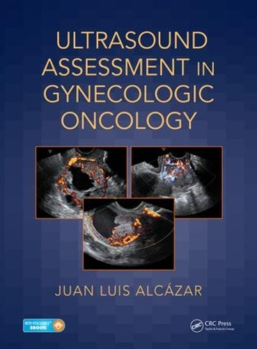 Бумажная книга «Ultrasound Assessment in Gynecologic Oncology», автор Хуан Луис Алькасар - фото №1