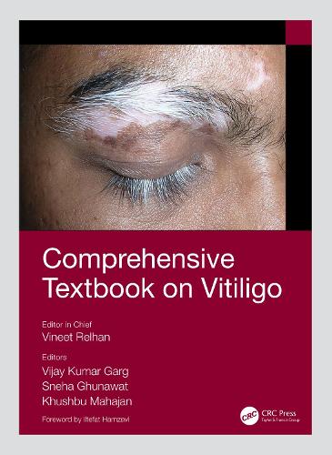 Бумажная книга «Comprehensive Textbook on Vitiligo» - фото №1