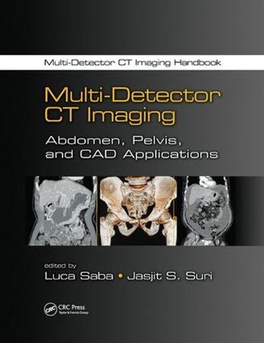 Паперова книга «Multi-Detector CT Imaging: Abdomen, Pelvis, and CAD Applications» - фото №1