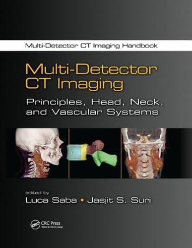 Паперова книга «Multi-Detector CT Imaging: Principles, Head, Neck, and Vascular Systems» - фото №1