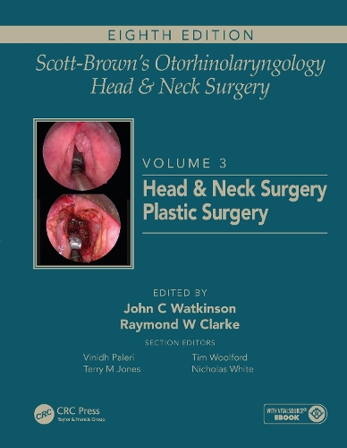 Бумажная книга «Scott-Brown's Otorhinolaryngology and Head and Neck Surgery: Volume 3: Head and Neck Surgery, Plastic Surgery» - фото №1