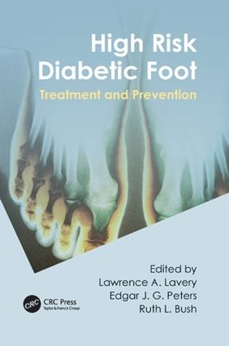 Паперова книга «High Risk Diabetic Foot: Treatment and Prevention» - фото №1