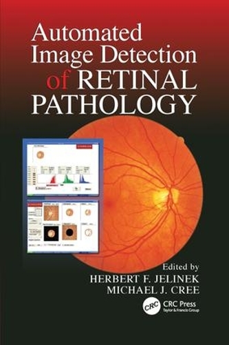 Паперова книга «Automated Image Detection of Retinal Pathology», авторів Герберт Єлінек, Майкл Дж. Крі - фото №1