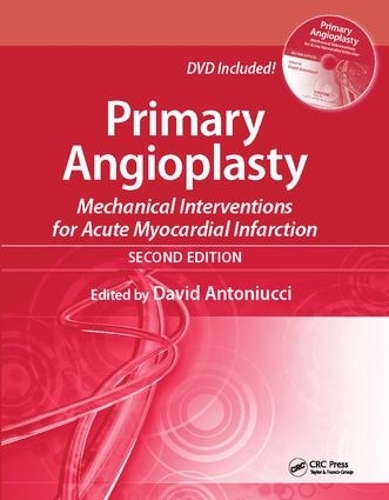 Паперова книга «Primary Angioplasty: Mechanical Interventions for Acute Myocardial Infarction, Second Edition» - фото №1
