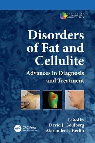 Бумажная книга «Disorders of Fat and Cellulite: Advances in Diagnosis and Treatment» - фото №1