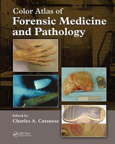 Бумажная книга «Color Atlas of Forensic Medicine and Pathology», авторов Брайан Хитон, Чарльз Катанезе - фото №1