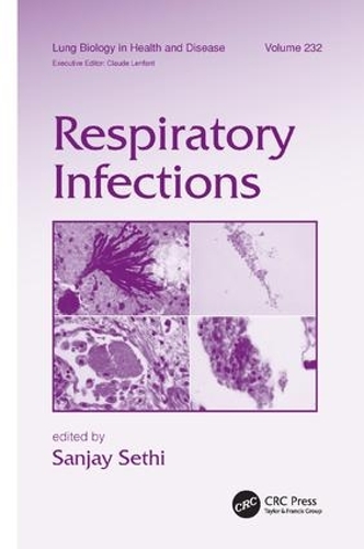 Бумажная книга «Respiratory Infections» - фото №1