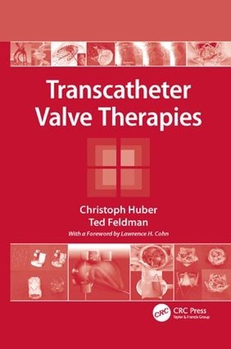 Бумажная книга «Transcatheter Valve Therapies», авторов Кристоф Хубер, Тед Фельдман - фото №1