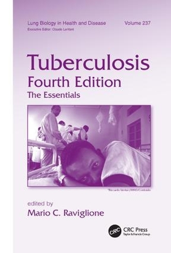 Паперова книга «Tuberculosis: The Essentials, Fourth Edition» - фото №1