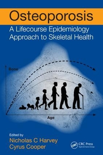 Бумажная книга «Osteoporosis: A Lifecourse Epidemiology Approach to Skeletal Health» - фото №1