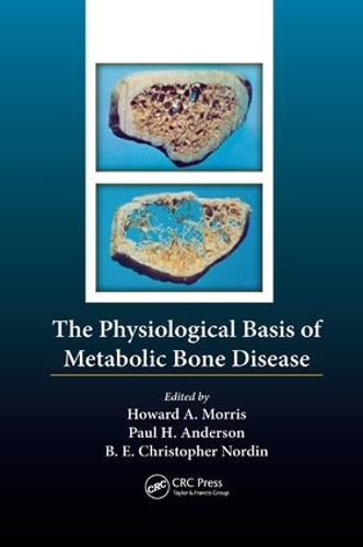 Паперова книга «The Physiological Basis of Metabolic Bone Disease» - фото №1