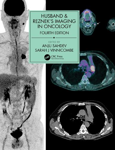 Бумажная книга «Husband & Reznek's Imaging in Oncology» - фото №1