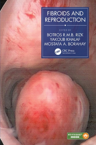 Паперова книга «Fibroids and Reproduction» - фото №1