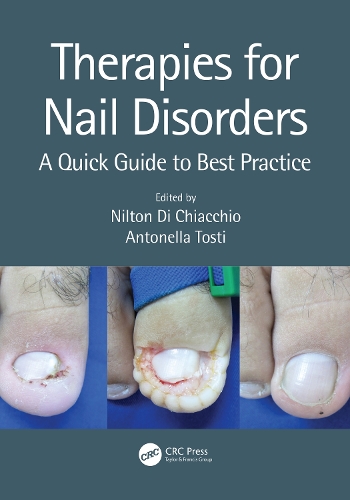 Бумажная книга «Therapies for Nail Disorders: A Quick Guide to Best Practice» - фото №1