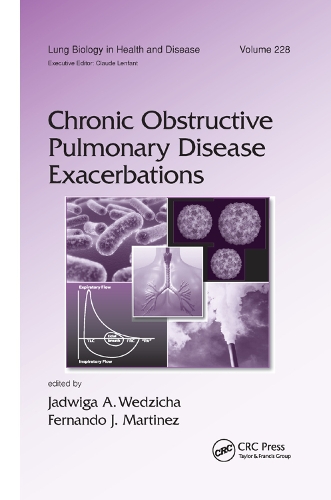 Бумажная книга «Chronic Obstructive Pulmonary Disease Exacerbations» - фото №1
