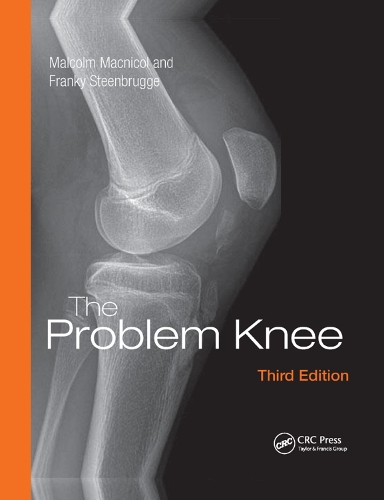 Паперова книга «The Problem Knee», авторів Френкі Стінбрюгге, Малкольм Макнікол - фото №1