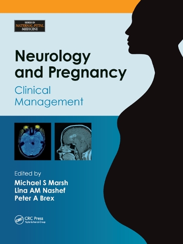 Бумажная книга «Neurology and Pregnancy: Clinical Management» - фото №1