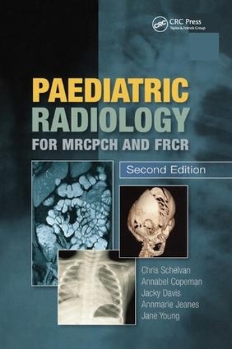 Бумажная книга «Paediatric Radiology for MRCPCH and FRCR, Second Edition», автор Копман Копман - фото №1