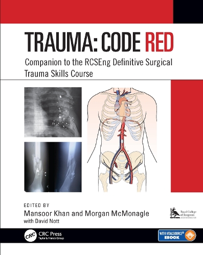 Бумажная книга «Trauma: Code Red: Companion to the RCSEng Definitive Surgical Trauma Skills Course» - фото №1