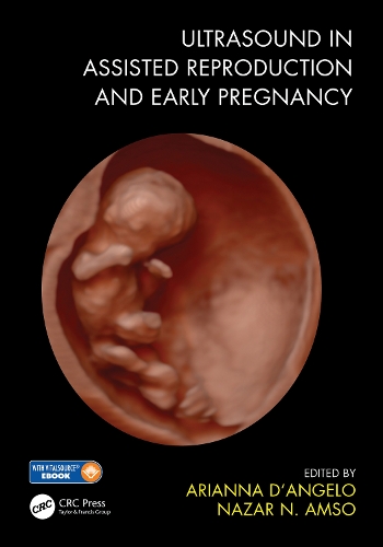 Бумажная книга «Ultrasound in Assisted Reproduction and Early Pregnancy» - фото №1
