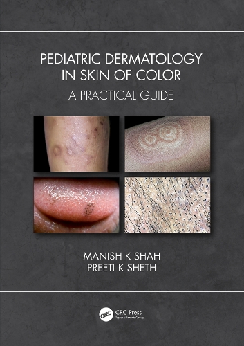 Бумажная книга «Pediatric Dermatology in Skin of Color: A Practical Guide», авторов Маниш К Шах, Прити К Шетх - фото №1
