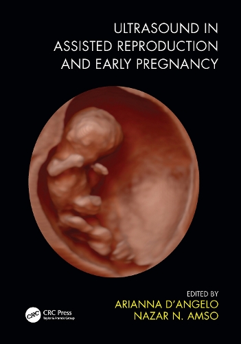 Паперова книга «Ultrasound in Assisted Reproduction and Early Pregnancy» - фото №1