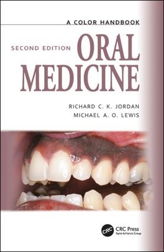 Паперова книга «Oral Medicine», авторів Майкл Льюїс, Річард Джордан - фото №1