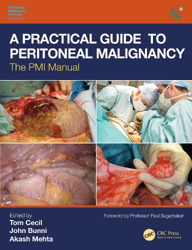 Бумажная книга «A Practical Guide to Peritoneal Malignancy: The PMI Manual» - фото №1