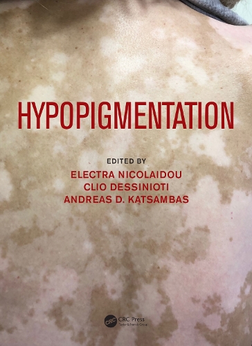 Паперова книга «Hypopigmentation» - фото №1