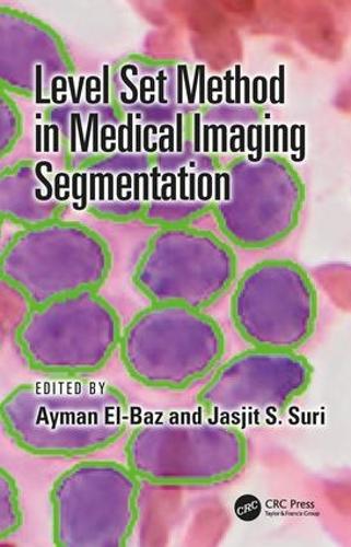 Бумажная книга «Level Set Method in Medical Imaging Segmentation» - фото №1