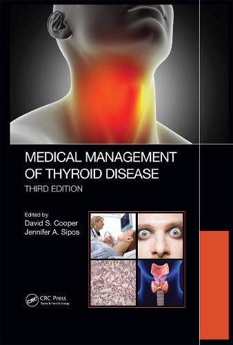 Бумажная книга «Medical Management of Thyroid Disease, Third Edition» - фото №1