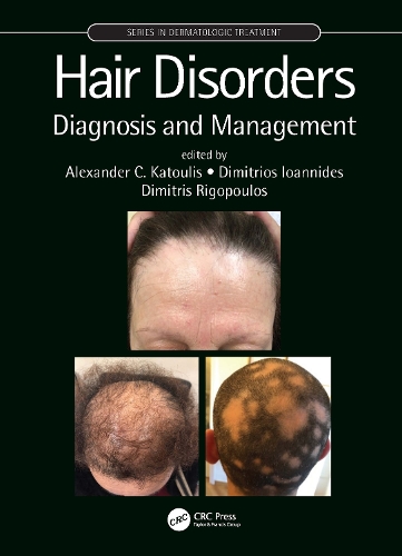 Бумажная книга «Hair Disorders: Diagnosis and Management» - фото №1