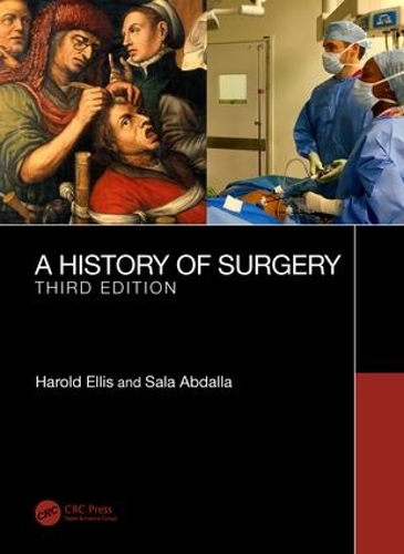 Бумажная книга «A History of Surgery: Third Edition», авторов Гарольд Эллис, Сала Абдалла - фото №1