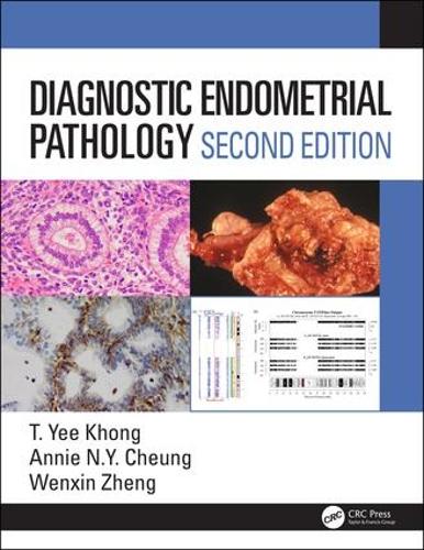 Паперова книга «Diagnostic Endometrial Pathology 2E», авторів Енні Н.Ю. Чунг, Веньсінь Чжен, Йі Хонг - фото №1