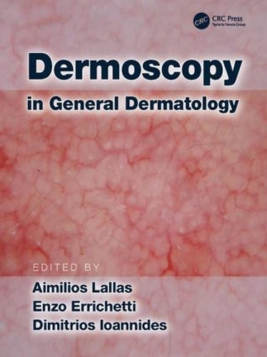 Бумажная книга «Dermoscopy in General Dermatology» - фото №1