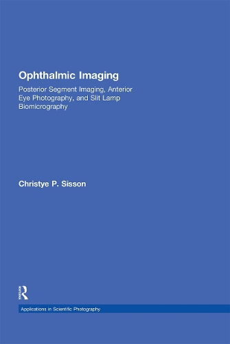 Бумажная книга «Ophthalmic Imaging: Posterior Segment Imaging, Anterior Eye Photography, and Slit Lamp Biomicrography», автор Кристи Сиссон - фото №1