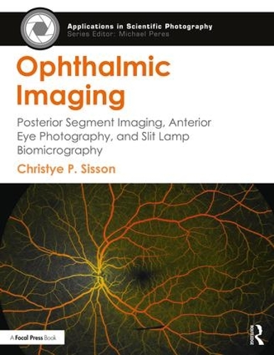 Бумажная книга «Ophthalmic Imaging: Posterior Segment Imaging, Anterior Eye Photography, and Slit Lamp Biomicrography», автор Кристи Сиссон - фото №1